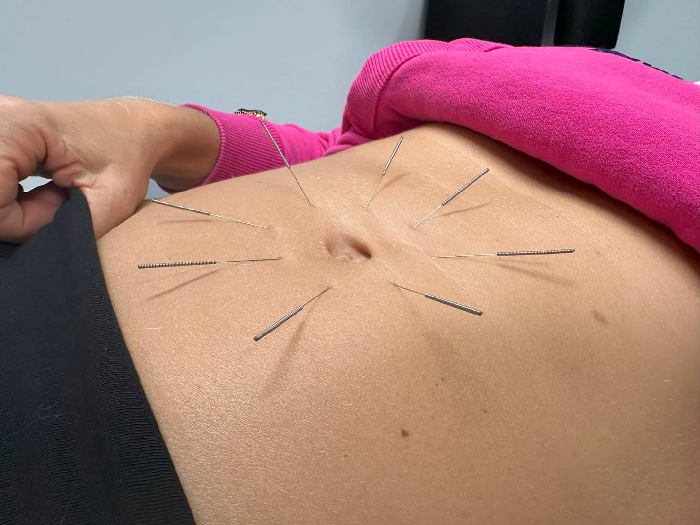soma_terapia-akupunktura_01