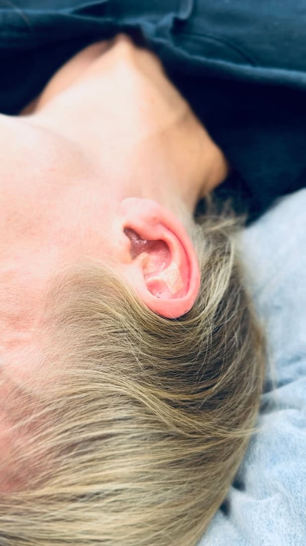 soma_terapia-bańki_aurikuloterapia_03